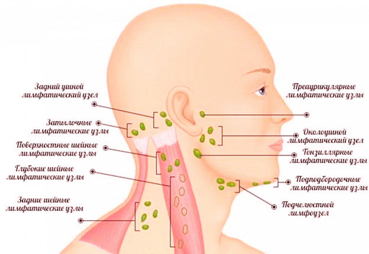 Фото: Лимфоузлы у человека